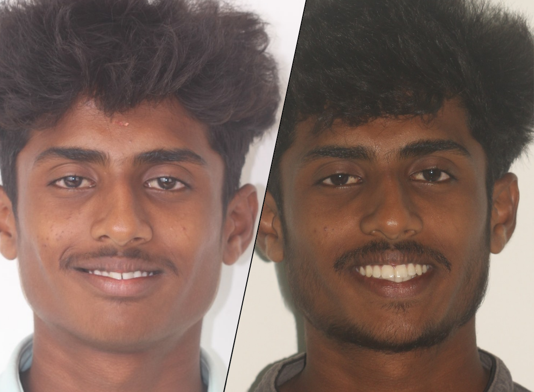 sumanth story